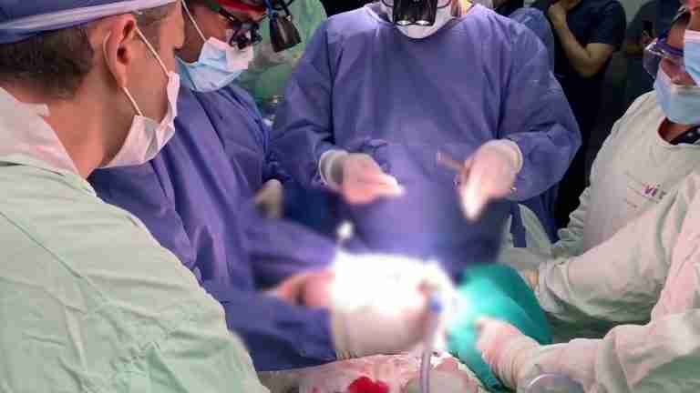 Aún en la placenta de la mamá, operaron a una bebé de 37 semanas en Medellín