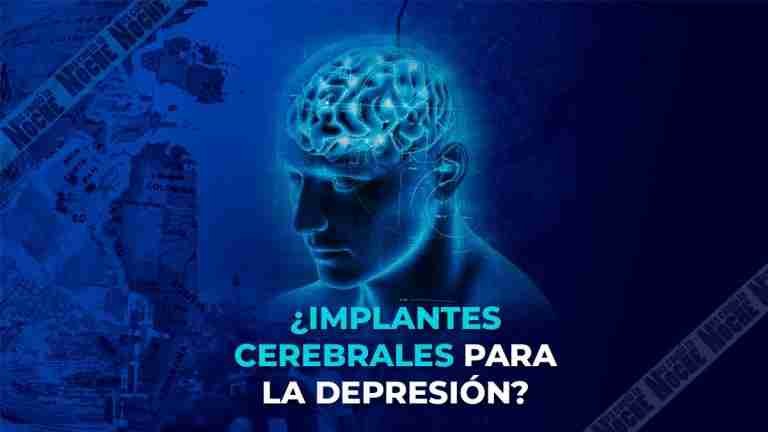¿Implantes cerebrales para tratar la depresión?
