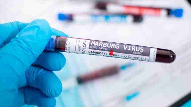 Virus de Marburgo: la enfermedad que asusta a África