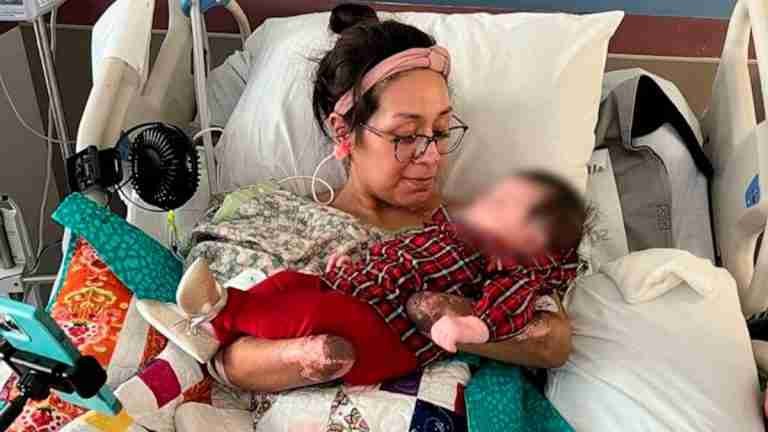 “Quiero mostrar mi pelea. Soy una sobreviviente”, mujer amputada por shock séptico