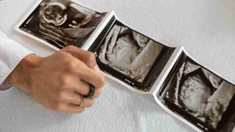 Según la OMS, 1 de cada 6 personas es infértil