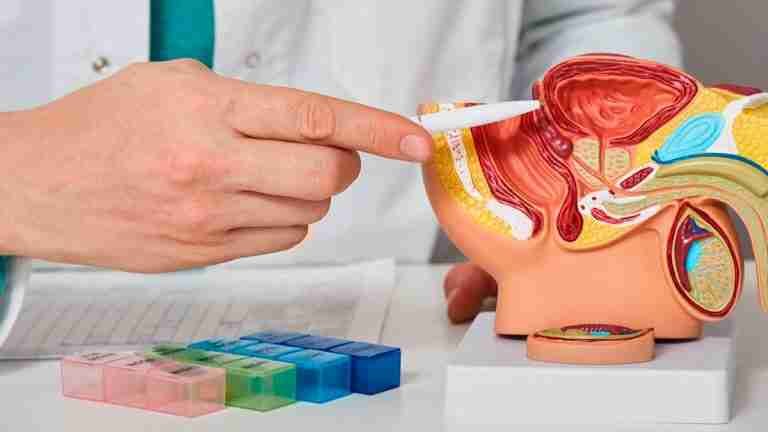 Subir mucho de peso en la juventud incrementaría el riesgo de desarrollar cáncer de próstata