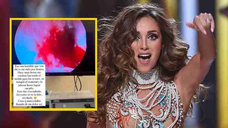 “No oigo nada”: Anahí se perfora el tímpano a dos meses de la gira de RBD
