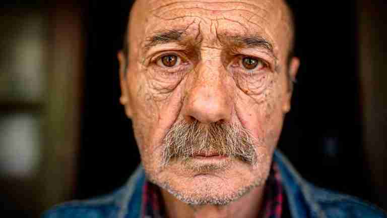 Arrugas que hablan: la piel como clave de nuestra salud