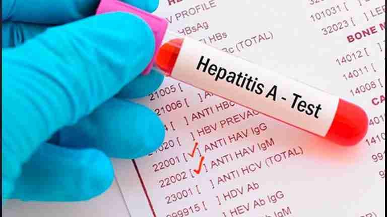 Alarma en Dagua, Valle del Cauca, por el aumento de casos de Hepatitis A