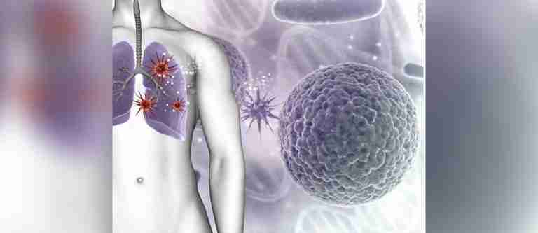 Líderes mundiales buscan estrategias para poner fin a la tuberculosis