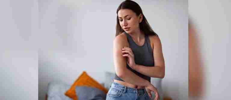 Recomendaciones para evitar el contagio de malaria