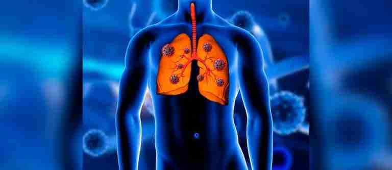 Día Internacional de Lucha contra el Cáncer de Pulmón