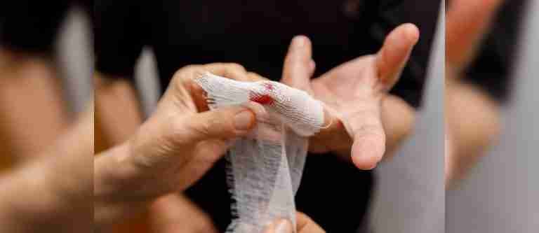 ¡Alarmante! Aumentan a 135 los casos de lesionados por pólvora en Antioquia