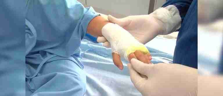 Con siete casos nuevos, Antioquia registra 142 lesionados por pólvora
