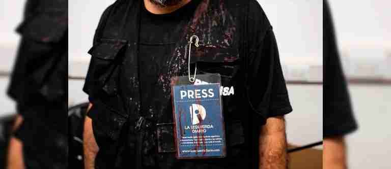 Cerca de 30 periodistas heridos durante represiones policiales en Argentina