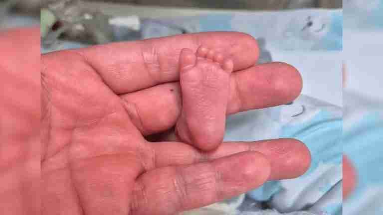 El milagro de Sara, la bebé que nació a sus 24 semanas de gestación