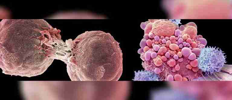 Nuevo fármaco ofrece esperanza en el tratamiento del cáncer de colon