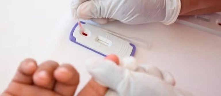 ¿Hace cuánto no te haces una prueba de VIH? Los casos en Antioquia van en aumento