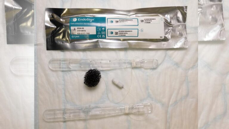 Farmacias del NHS probarán método innovador para detectar cáncer de esófago