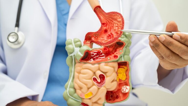 5 alimentos que pueden mejorar tu salud digestiva según nutricionistas colombianos
