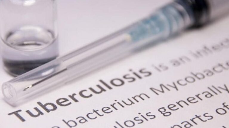 Tuberculosis preocupa en el Valle: autoridades refuerzan llamado a la prevención y al diagnóstico temprano