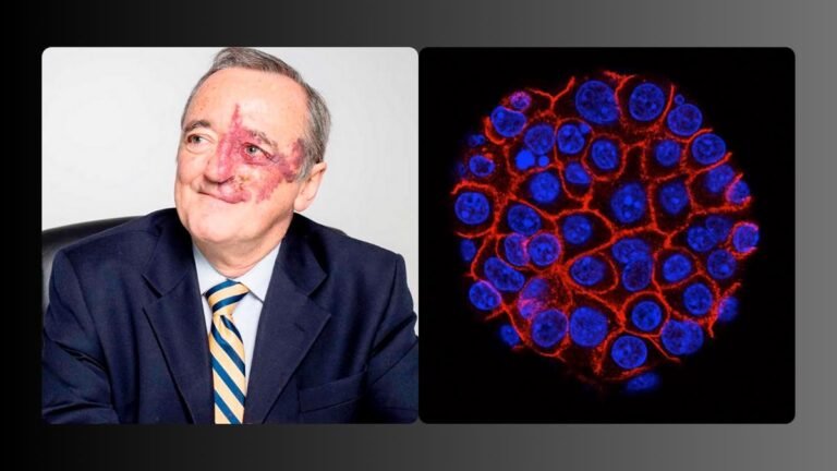 Científicos españoles publican avances clave contra el cáncer de páncreas