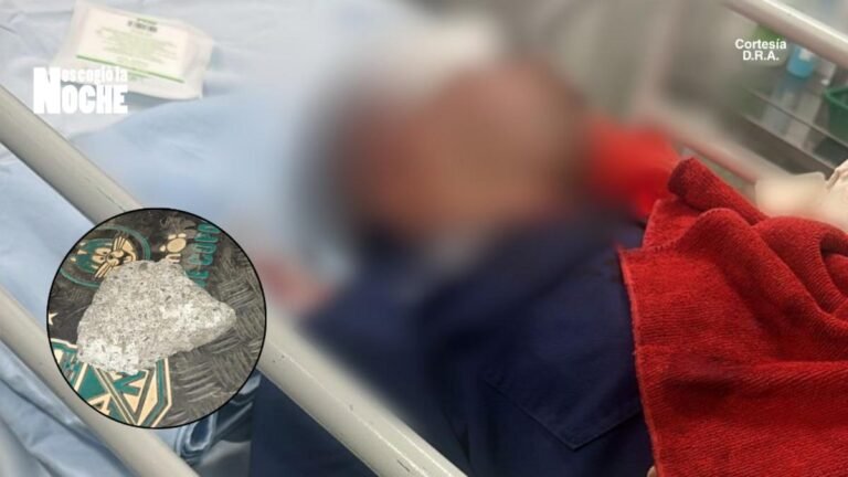 En la Comuna 13, un motociclista agredió con una piedra a un conductor de grúa que le llevaba la moto para los patios